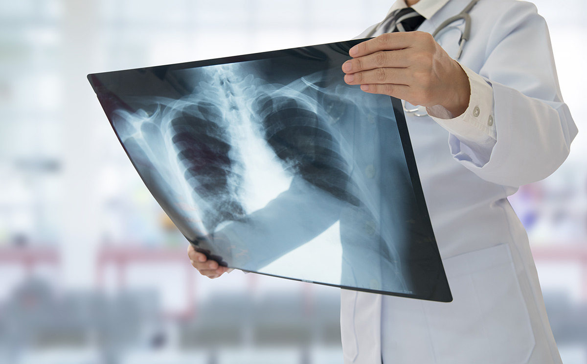 Read more about the article Conheça os tipos de raio-x e para quais diagnósticos eles são utilizados